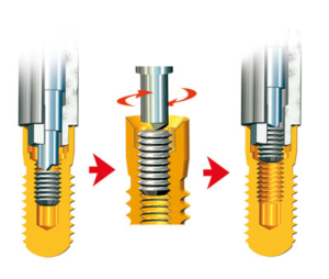 KIT DE EXTRACCION TORNILLOS ROTOS IMPLANTES DENTALES