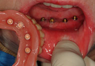 Ot equator impianti 005 rhein83 rhein83