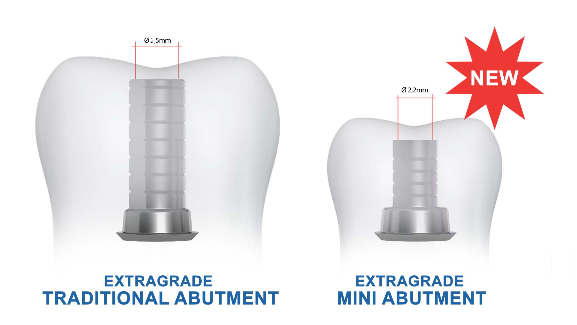 Traditional and mini extragrade titanium abutment