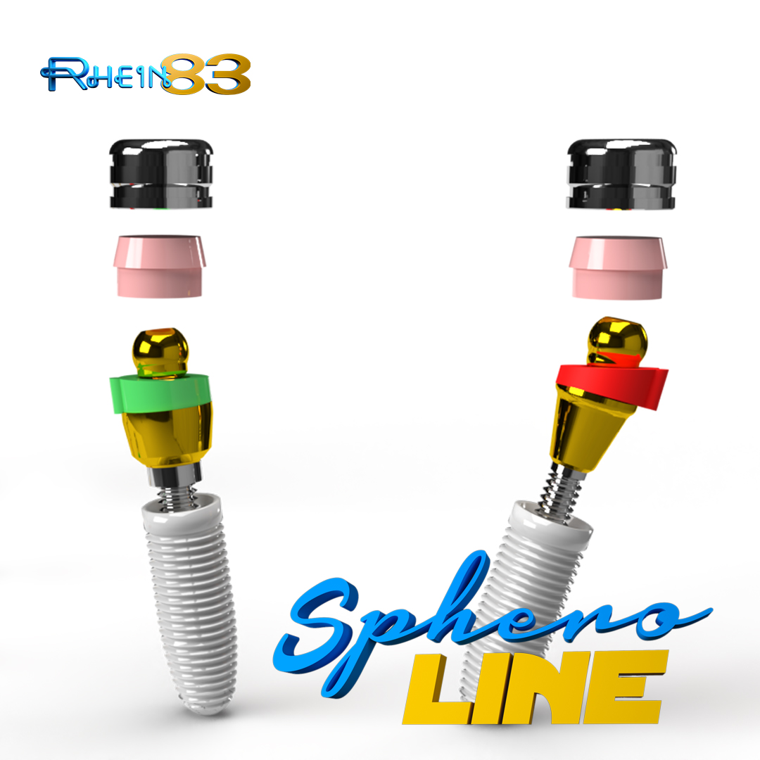 Implant retained overdenture with Ball Attachments Rhein83