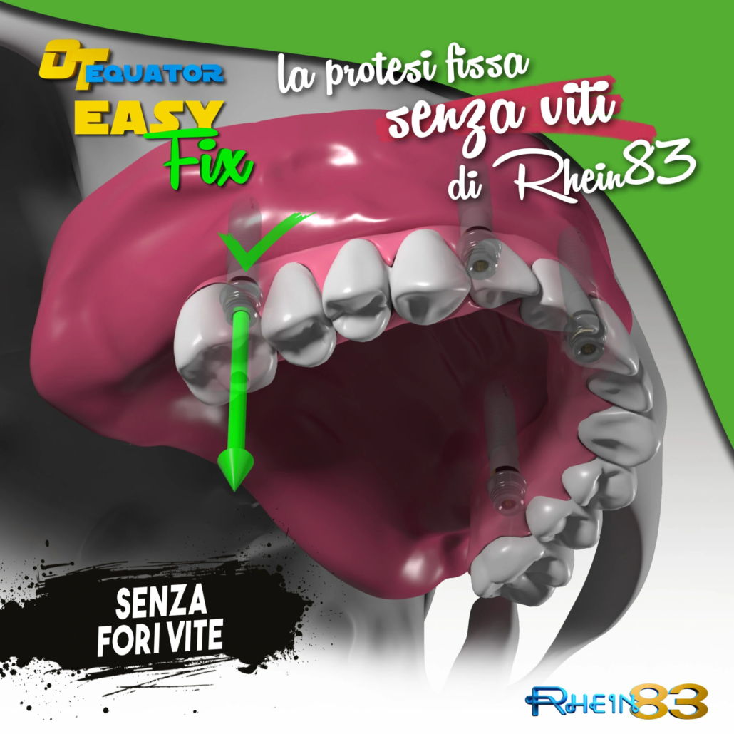 OT_Equator_Easy_Fix_25_06_20252