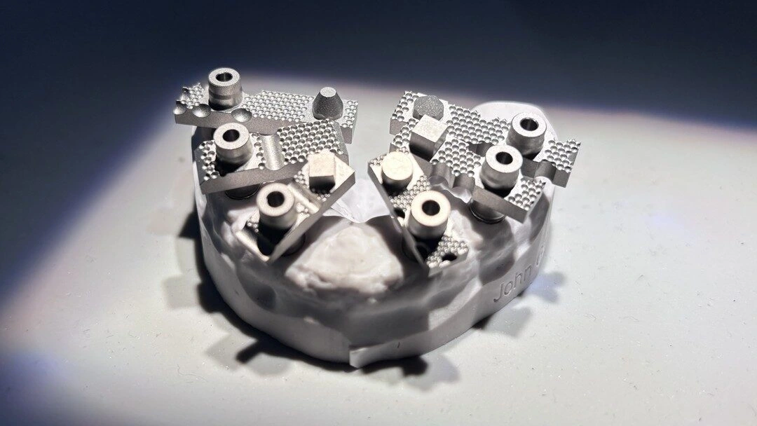 3D-printed metal dental surgical guide with lattice supports on a circular base segment