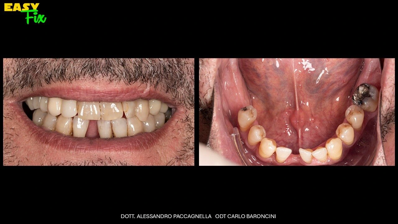 Diapositiva1