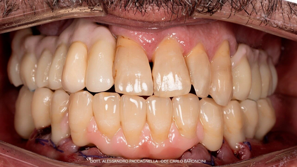 Diapositiva10