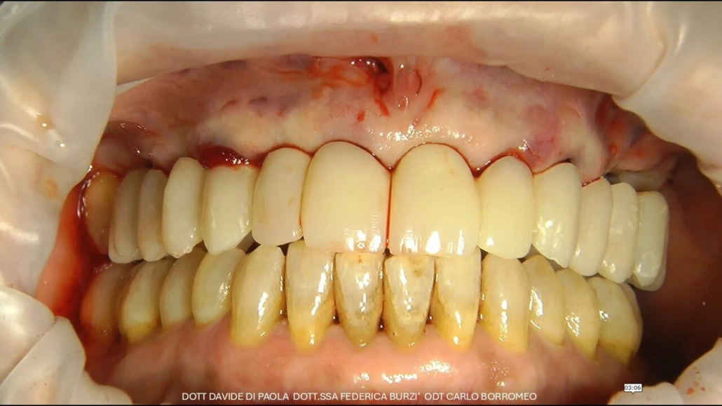 Diapositiva10