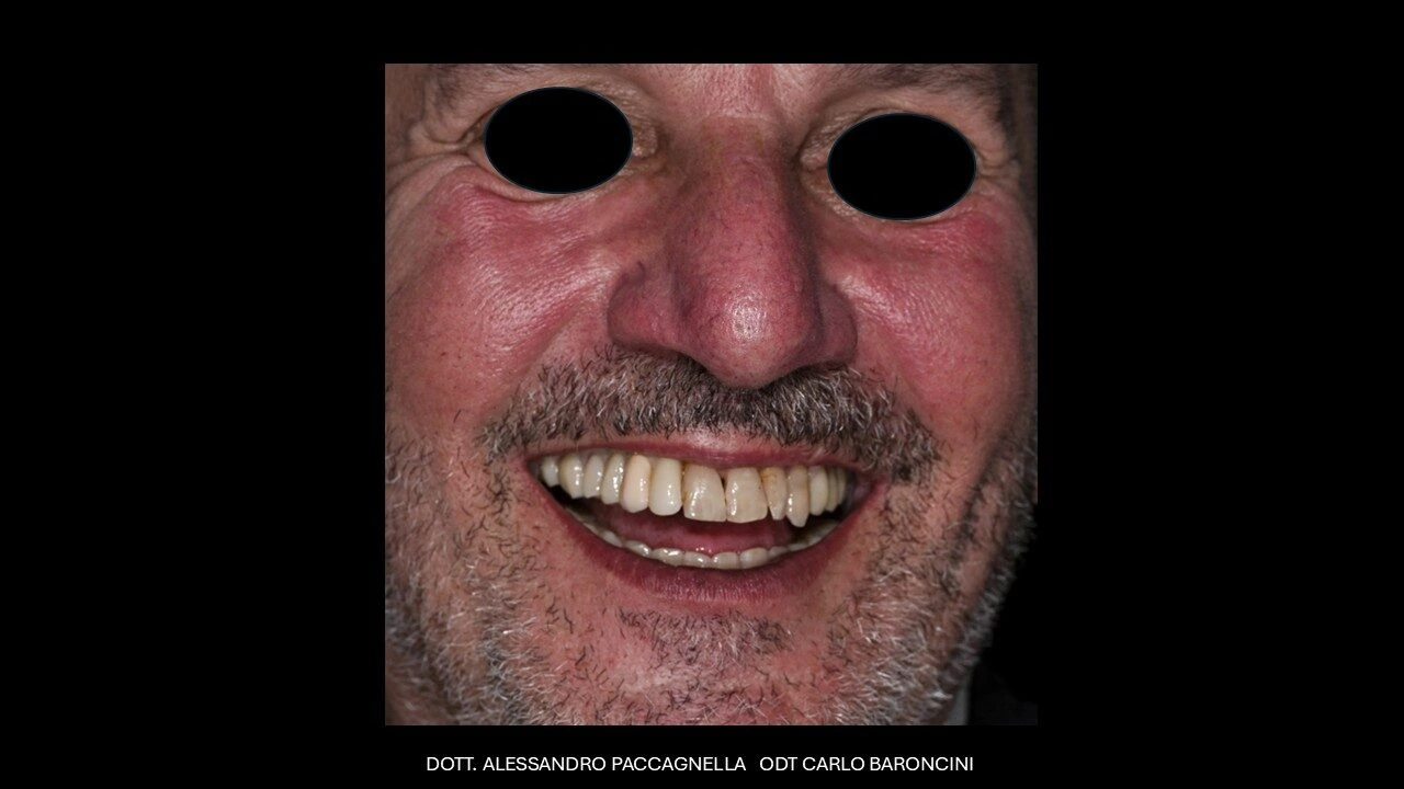 Diapositiva11