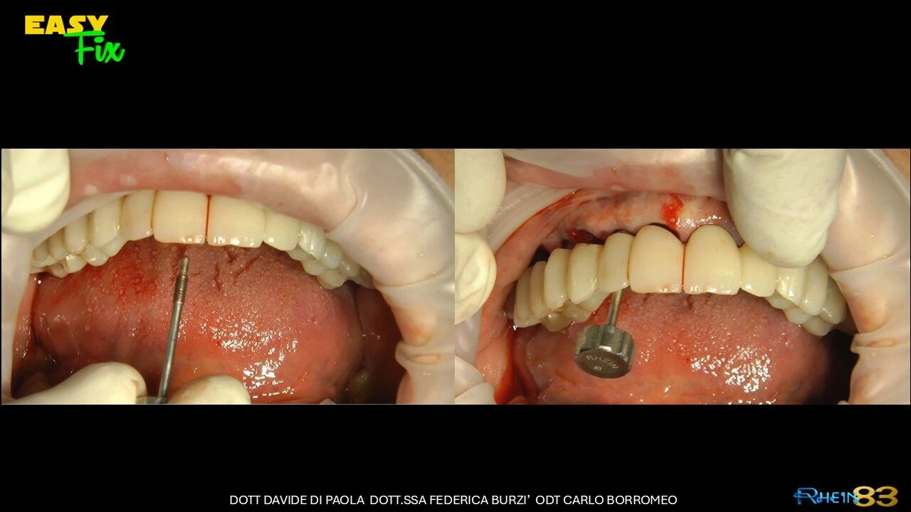 Diapositiva11