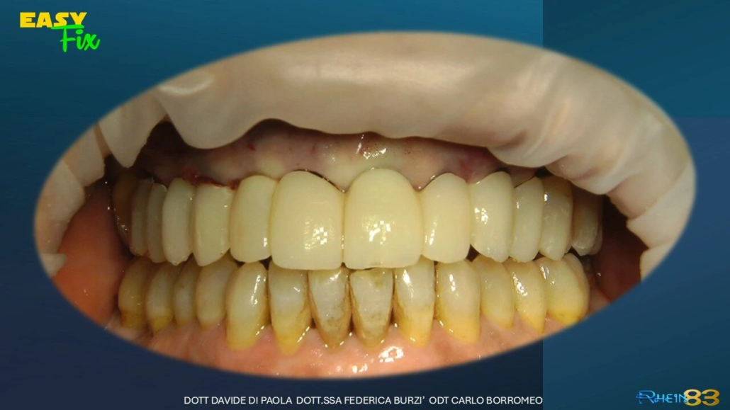 Diapositiva12