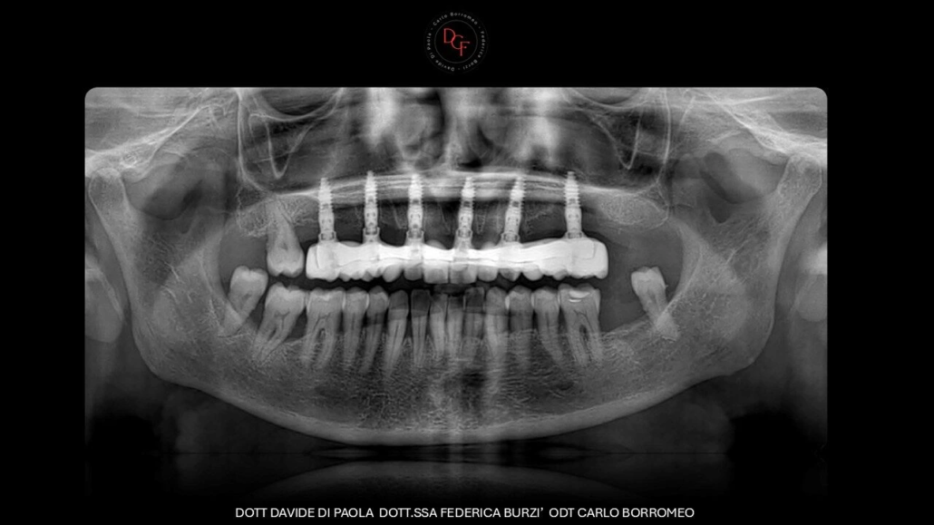 Diapositiva14