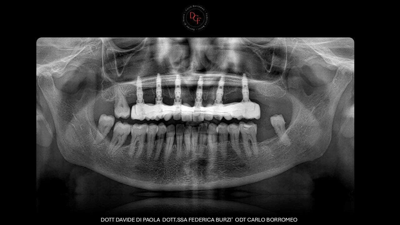 Diapositiva14