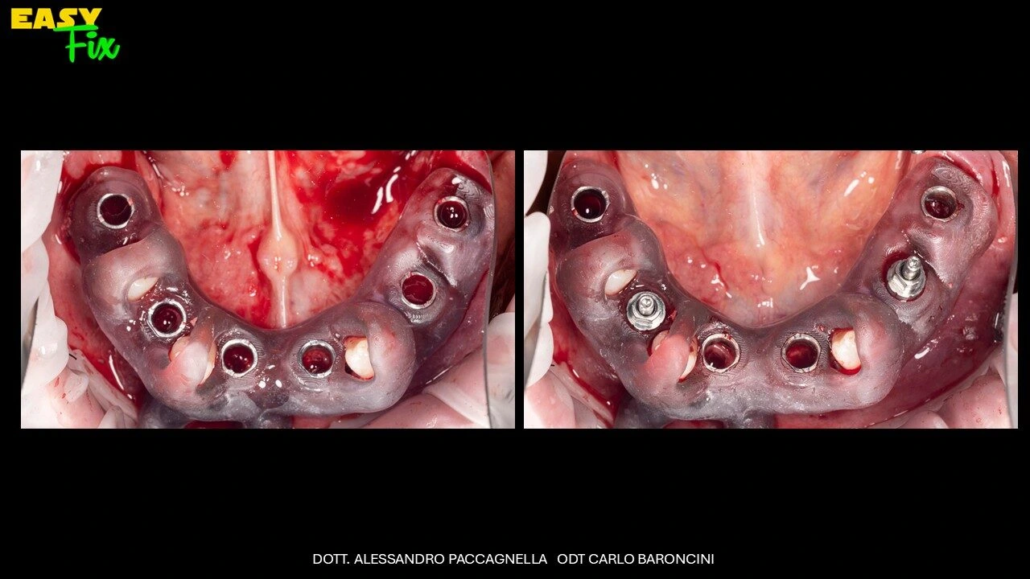 Diapositiva3