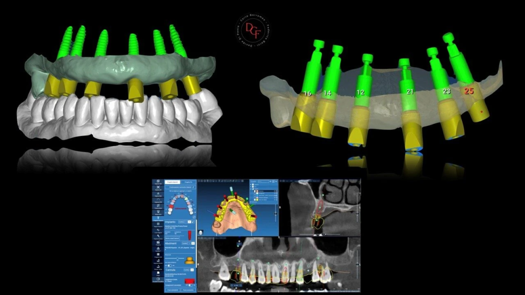 Diapositiva4
