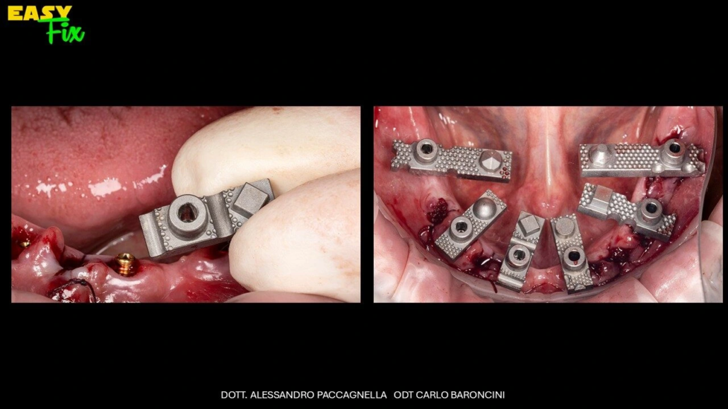 Diapositiva5
