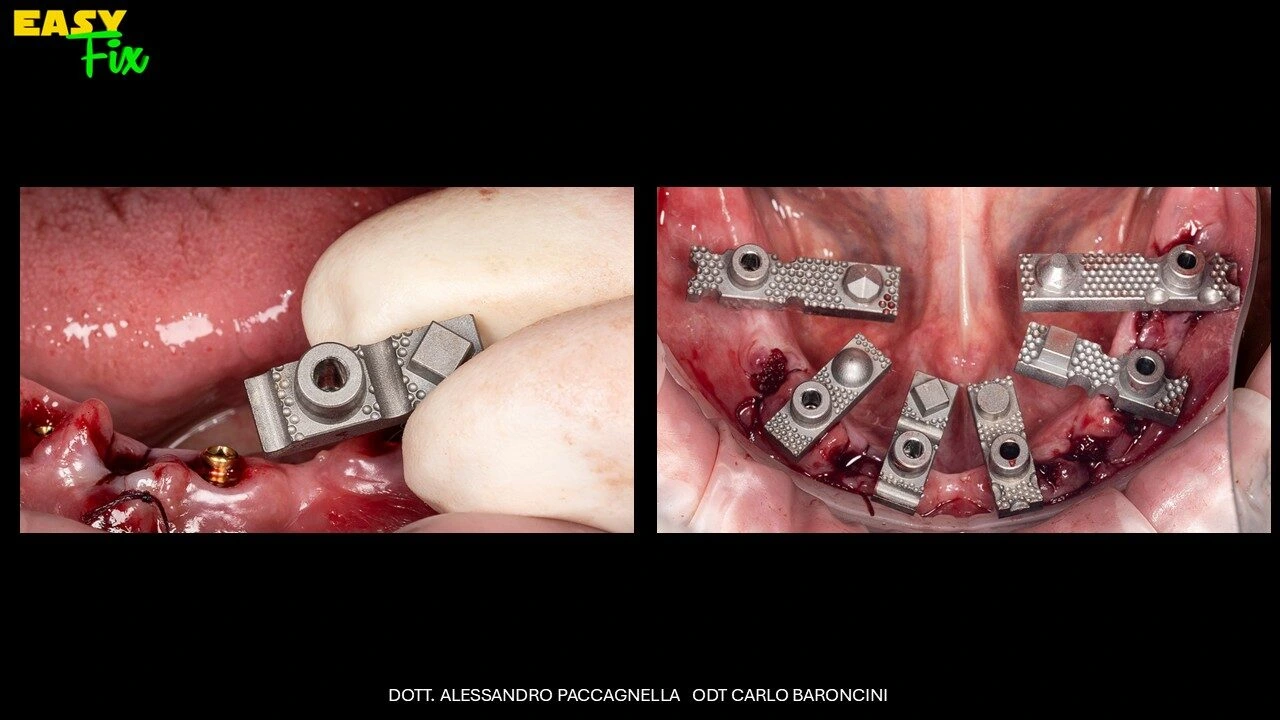 Diapositiva5