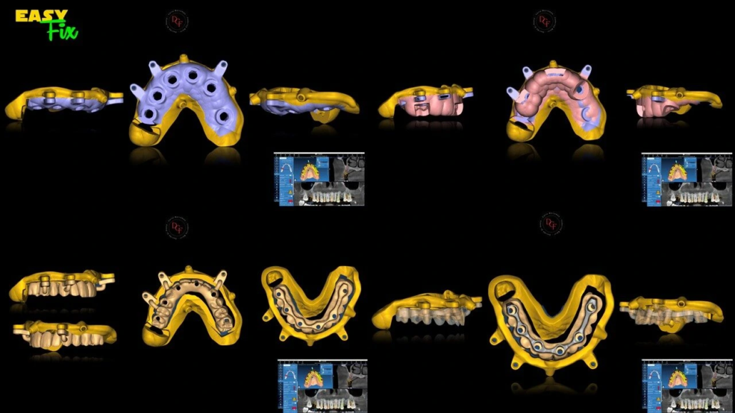 Diapositiva6