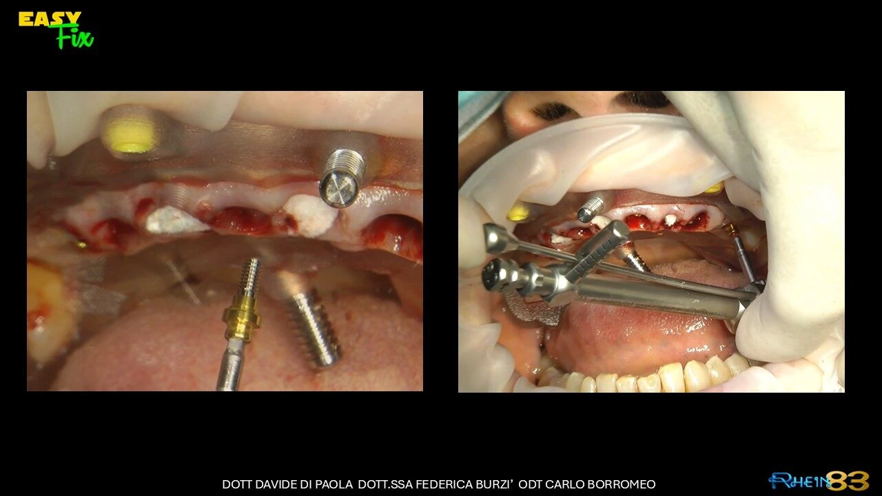 Diapositiva8