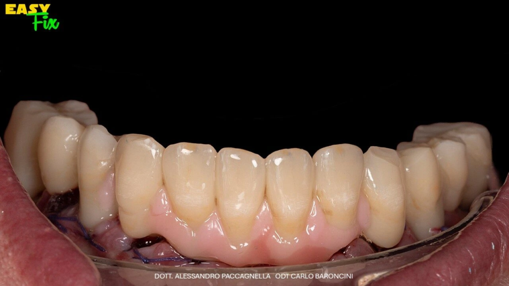 Diapositiva9