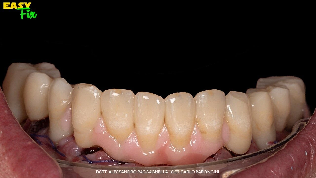 Diapositiva9