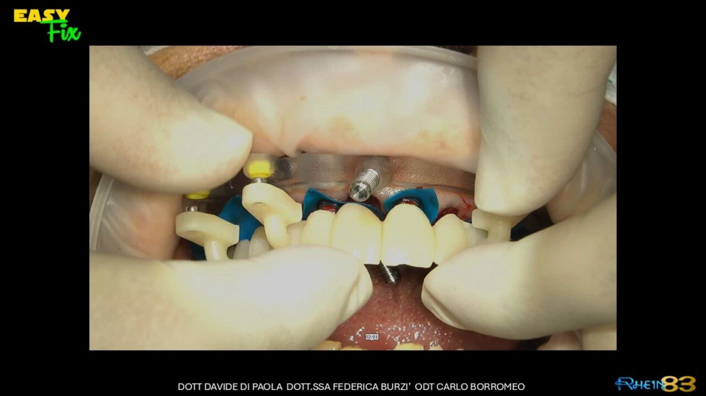 Diapositiva9
